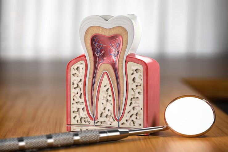 Root Canal Therapy Near You