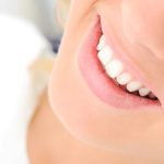 what are the benefits of professional teeth whitening