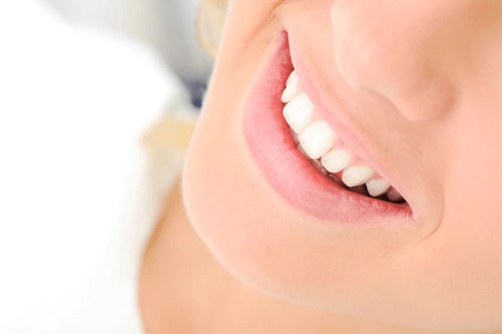 what are the benefits of professional teeth whitening