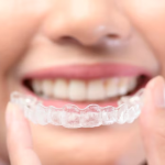 understanding-the-30-minute-rule-how-it-impacts-your-invisalign-experience