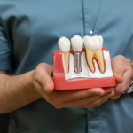 Why Dental Implants are a Better Option than Dentures